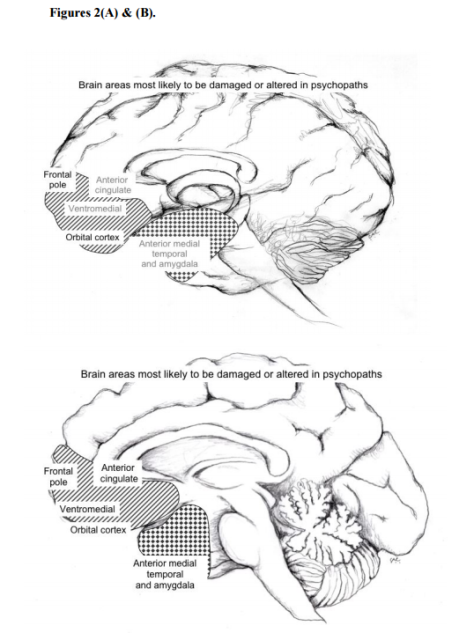Figure (Brain of a Psychopath)